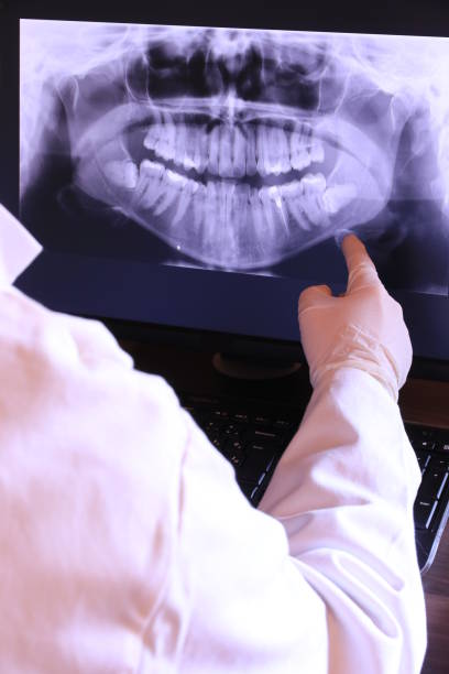 Best Emergency Dental Care for Broken or Chipped Teeth in Roseville, MN