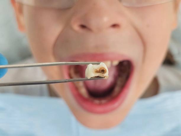 Best Pediatric Emergency Dentist in Roseville, MN